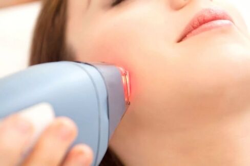 Laser hair removal for the skin of the face
